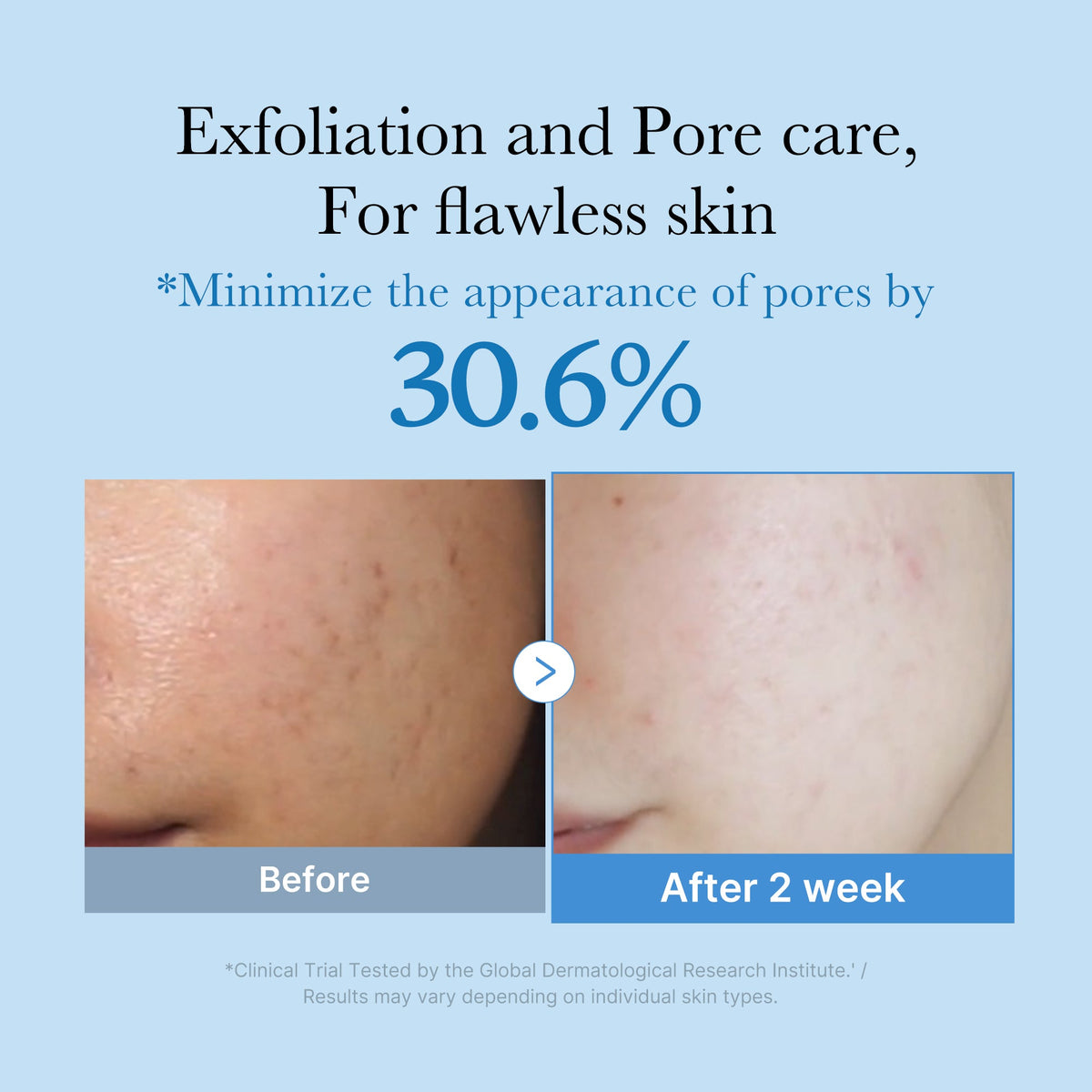 Zero Pore Toner M8