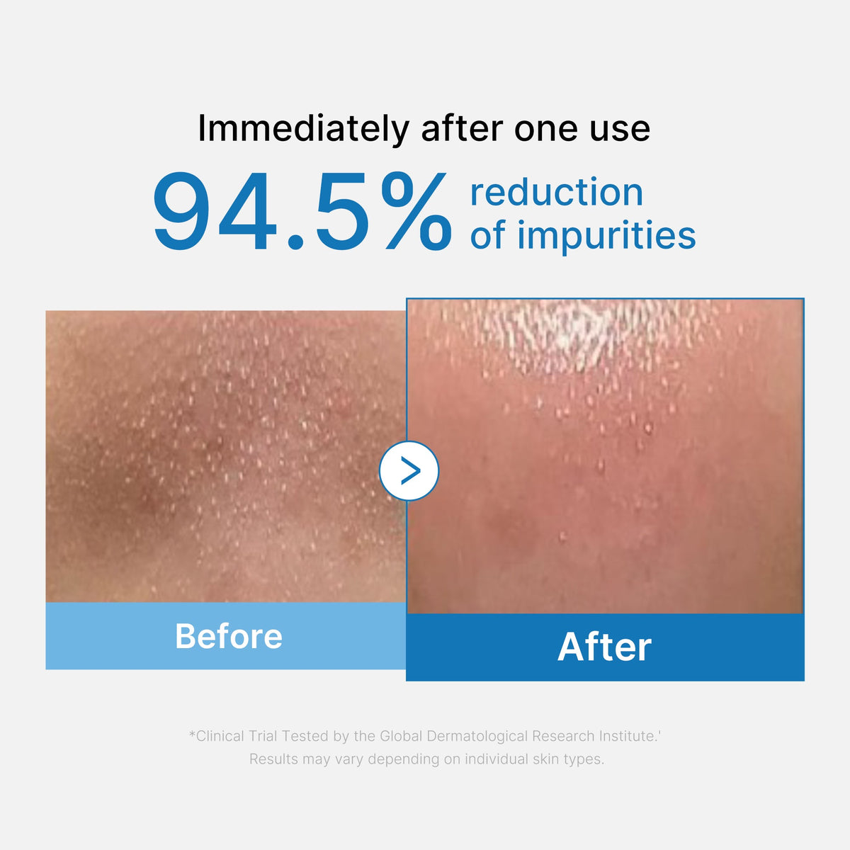 Zero Pore Blackhead Deep Cleansing Oil A2