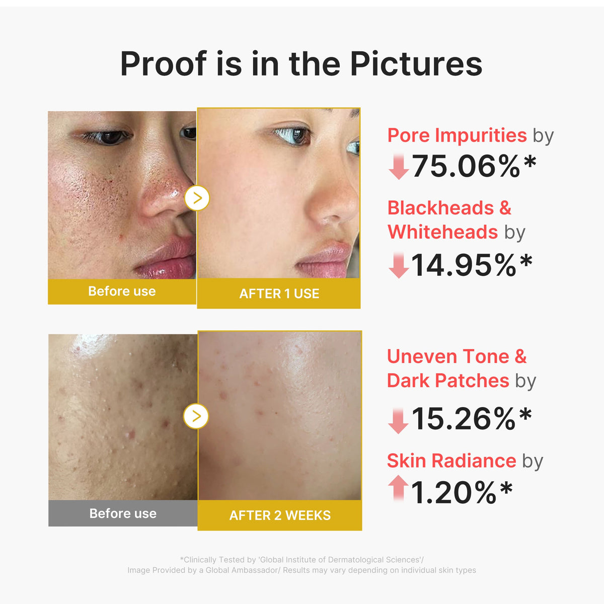 Kojic Acid Turmeric Peel Shot U8