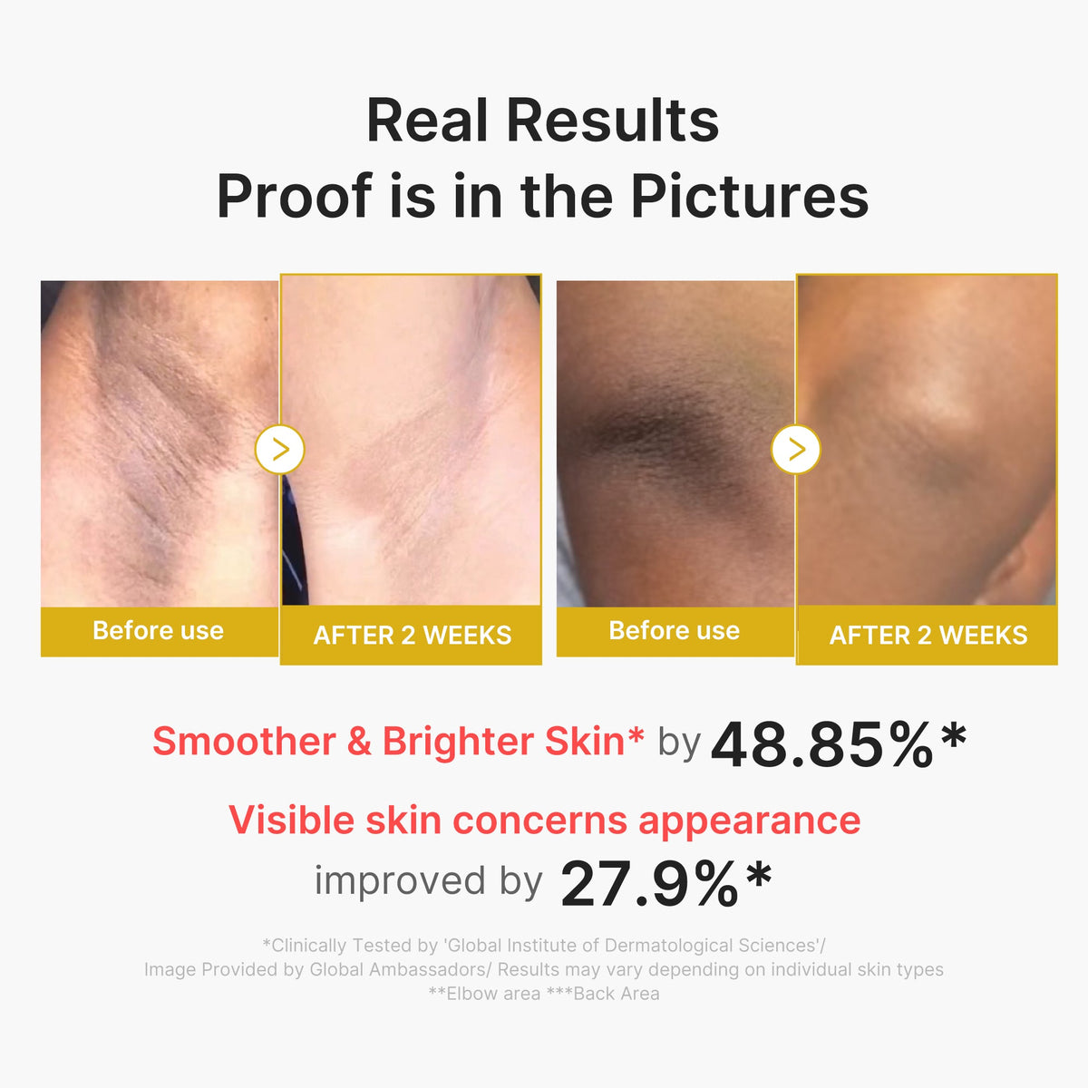 Kojic Acid Turmeric Body Peel Shot A3