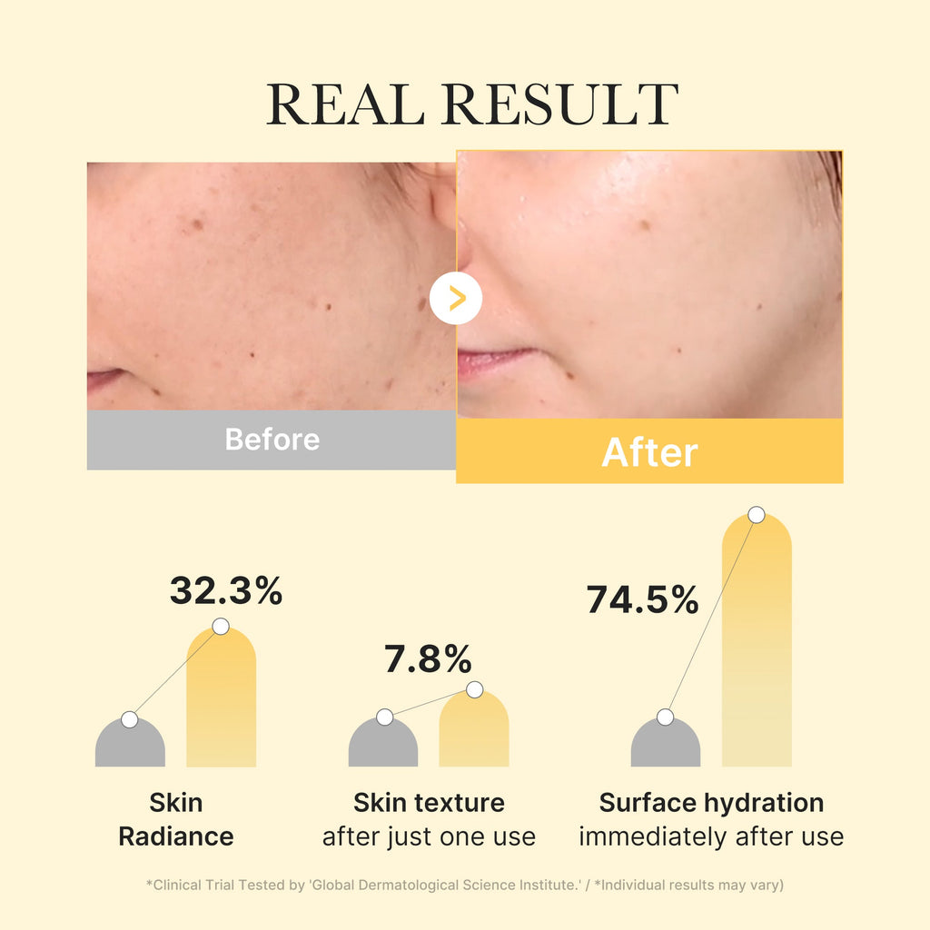 Kojic Acid Turmeric Gold Jelly Gel Mask R5