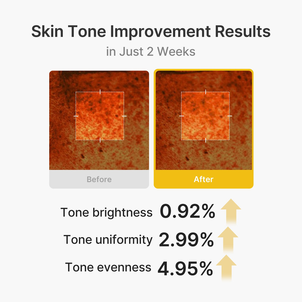 Kojic Acid Turmeric Vita Capsule Cream J9