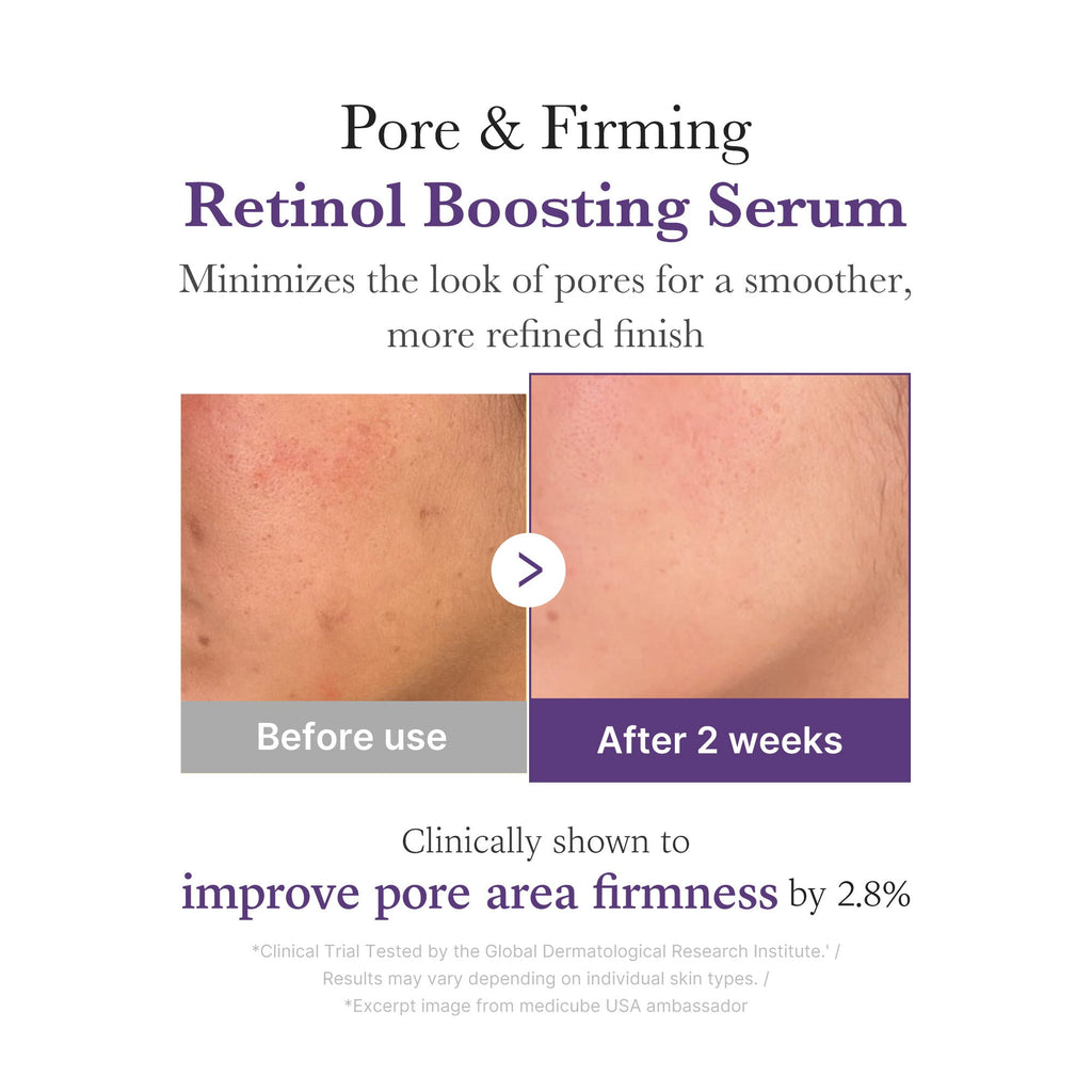 Retinol NMN Boosting Serum V1