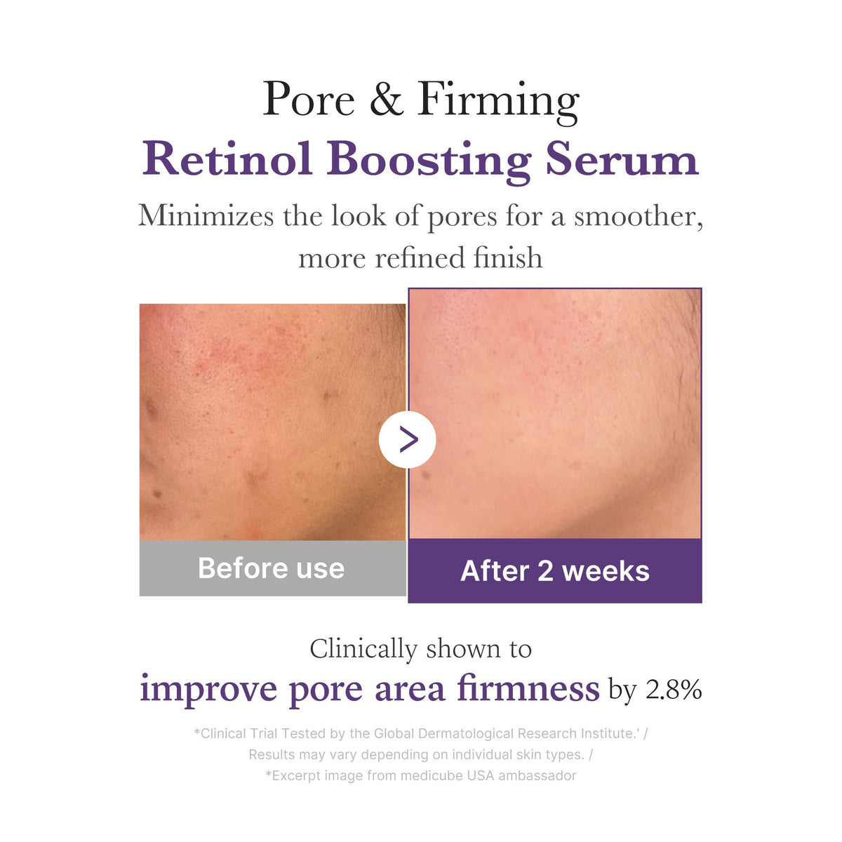 Retinol NMN Boosting Serum V1