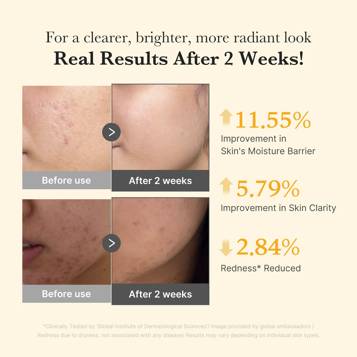 Kojic Acid Turmeric Capsule Serum Q0