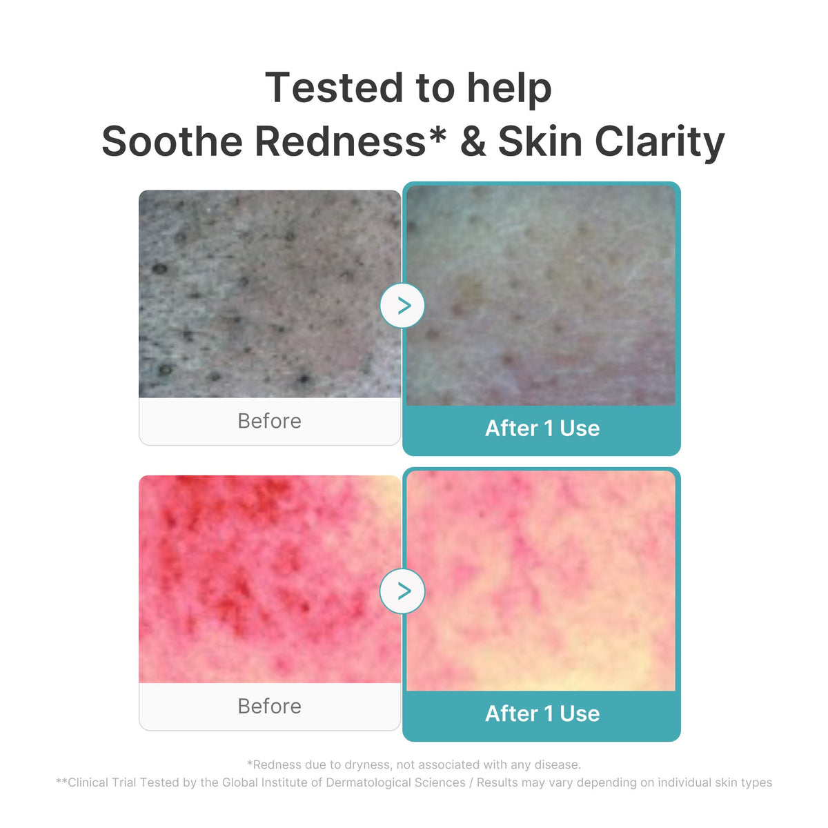 Azelaic Acid Capsule Foam Cleanser D7