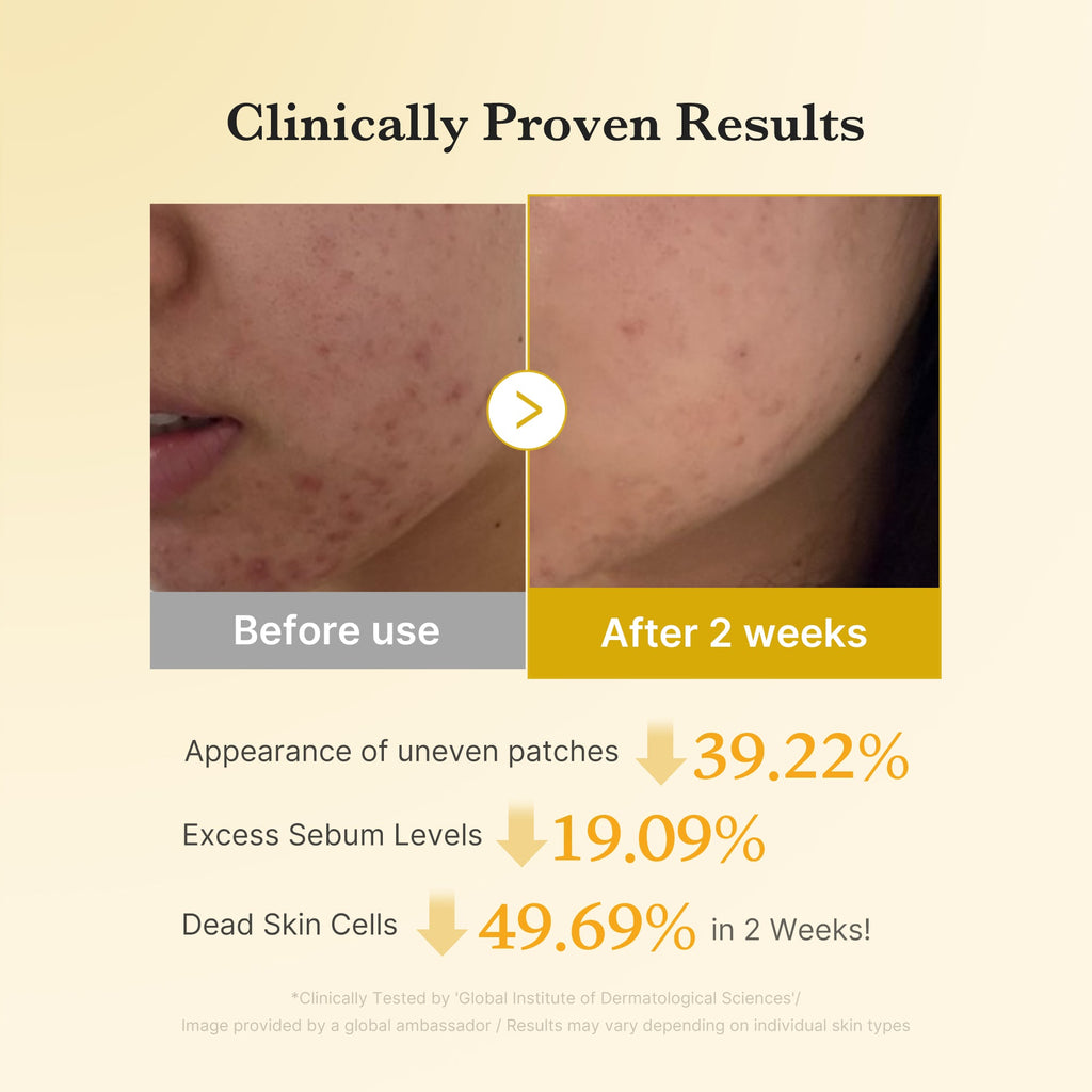 Kojic Acid Tumeric Toner Pad O7