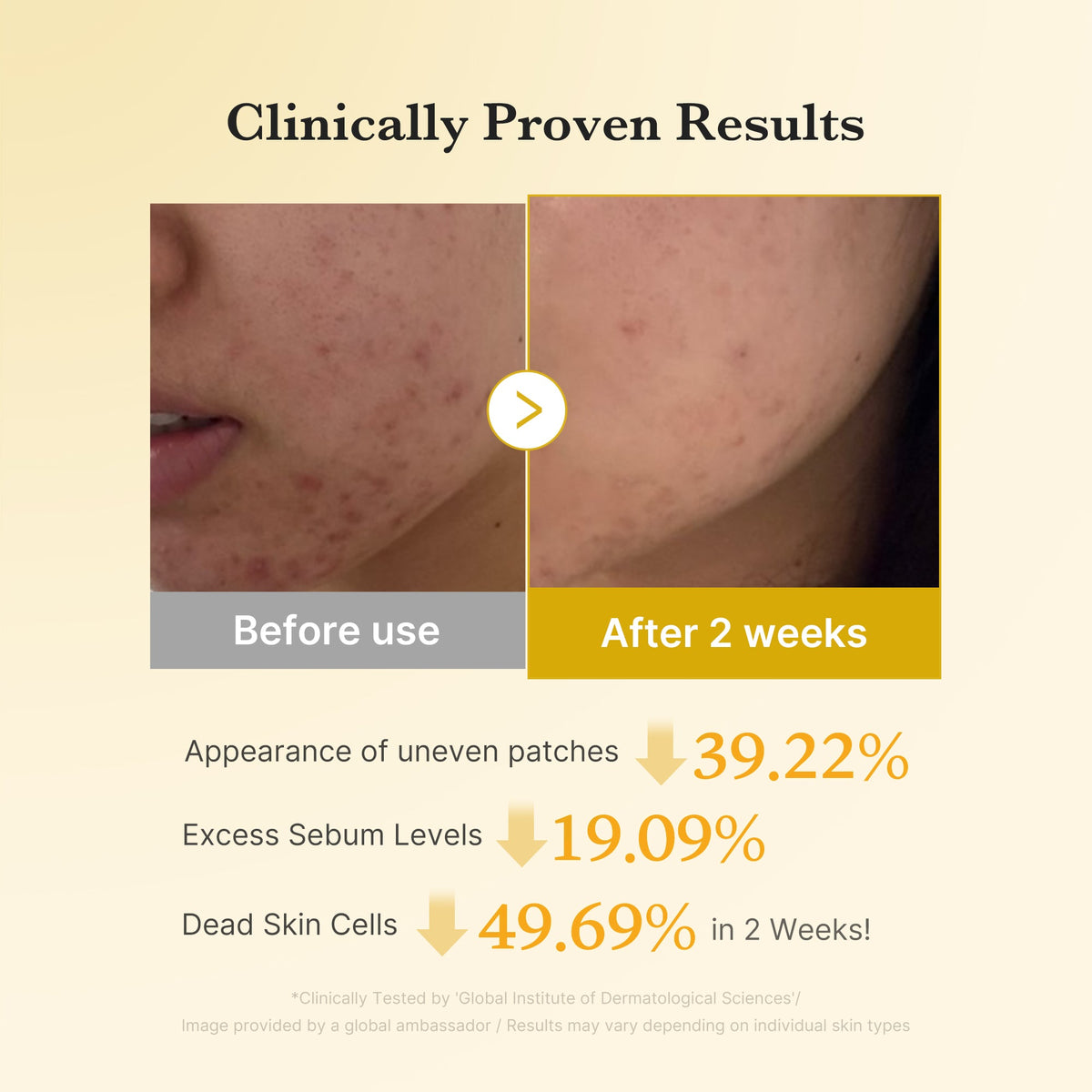Kojic Acid Tumeric Toner Pad O7