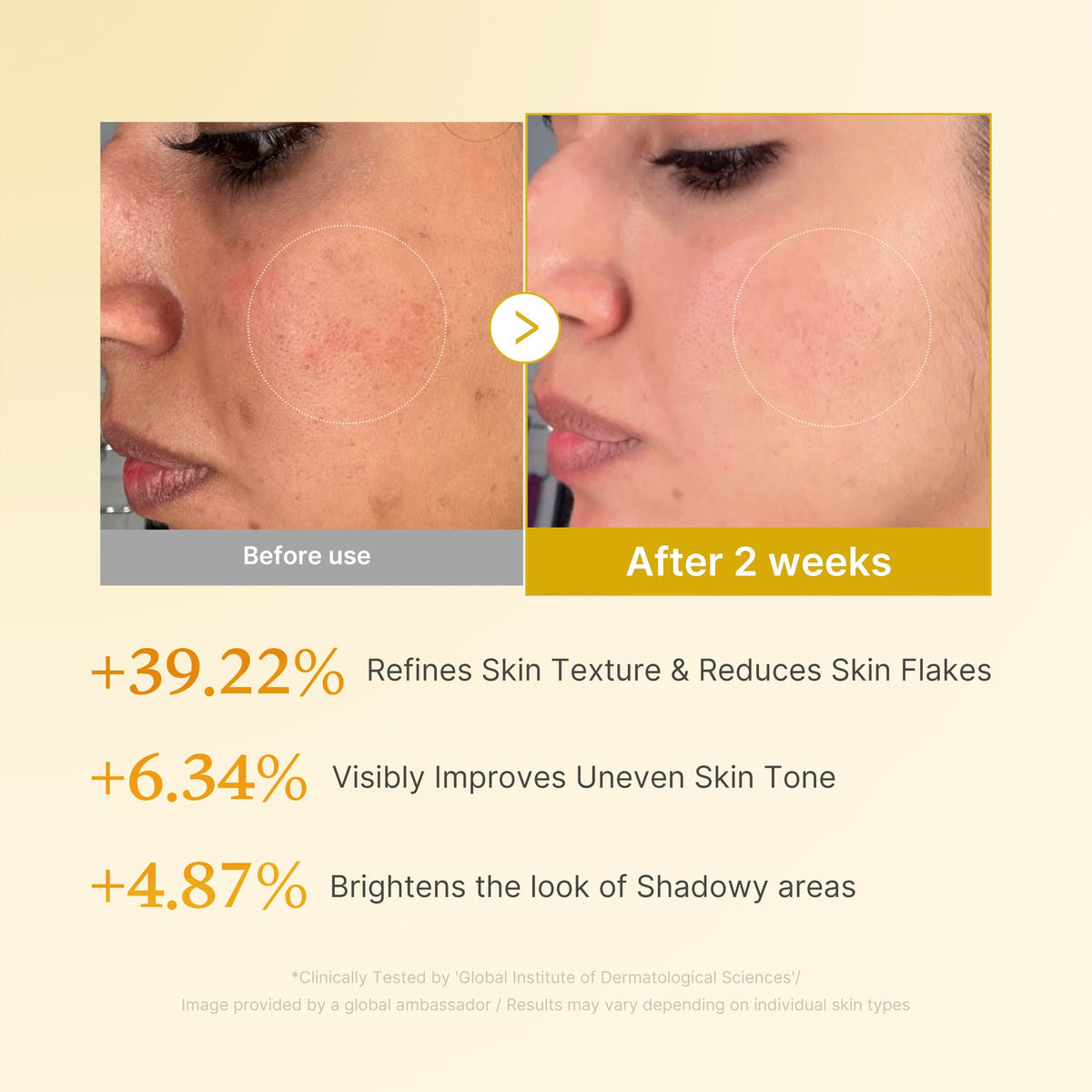 Kojic Acid Turmeric Toner I1