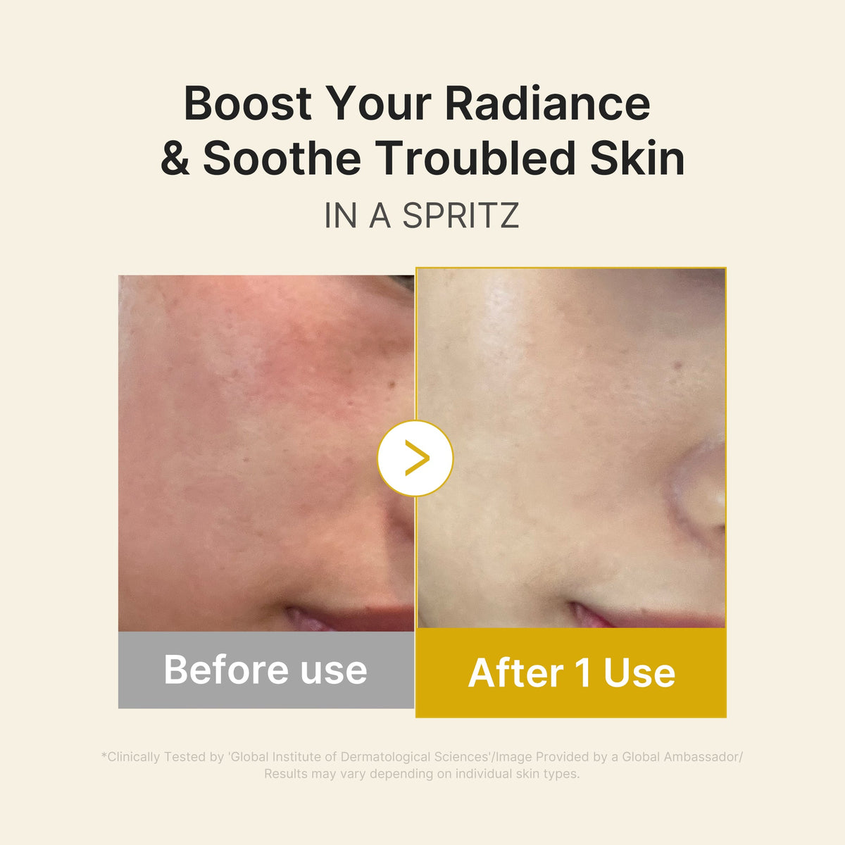 Kojic Acid Turmeric Vitamin Gold Jelly Mist Serum M0