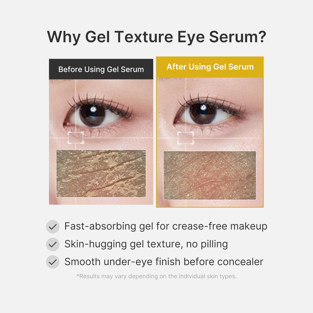 Kojic Acid Tumeric Eye Gel Serum O2