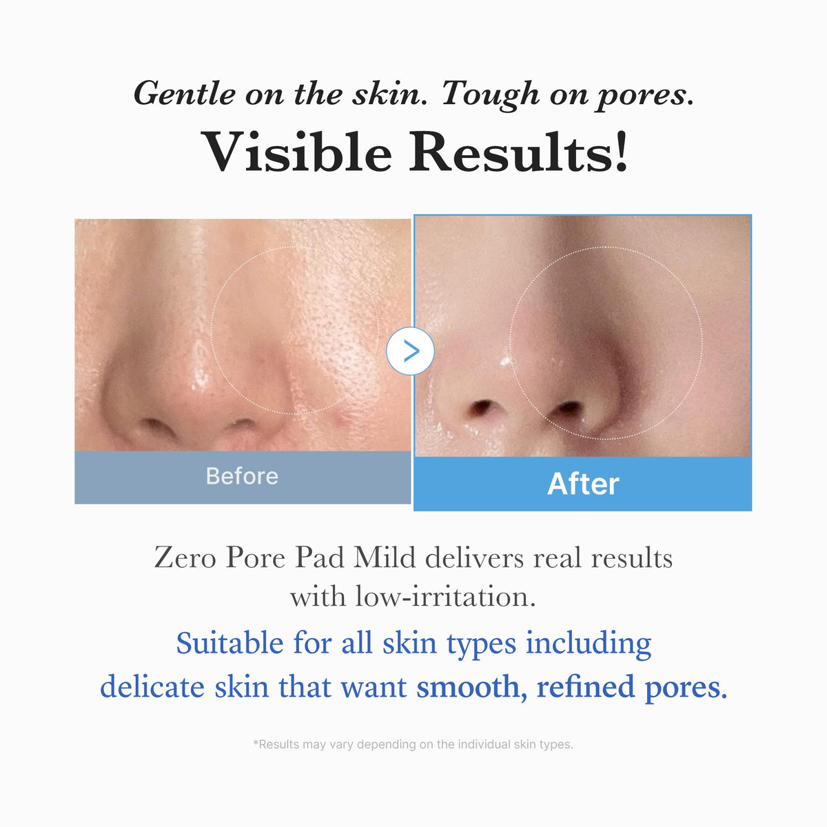 Zero Pore Madecassoside Pads (Mild) P4