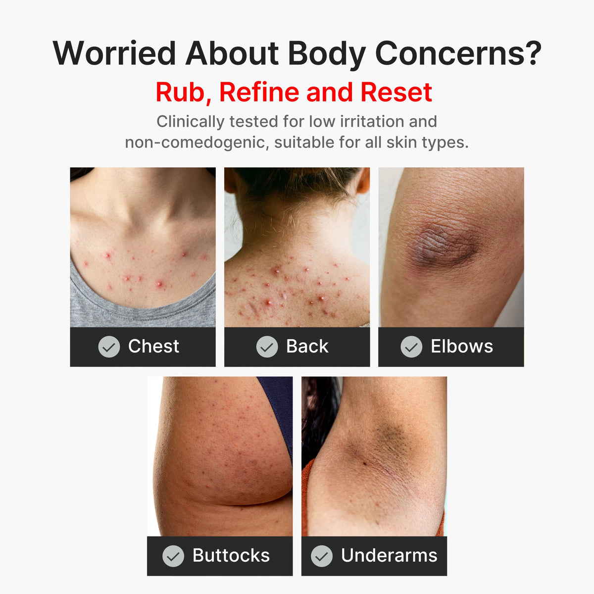 Kojic Acid Turmeric Body Peel Shot A3