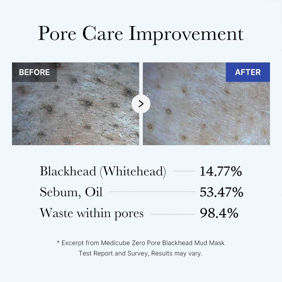 Zero Pore Blackhead Mud Mask T8