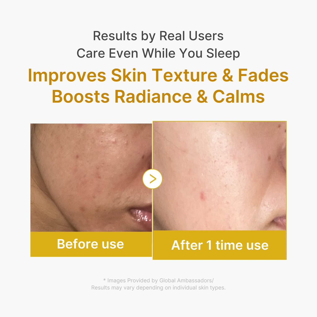 Kojic Acid Turmeric Overnight Wrapping Mask W1