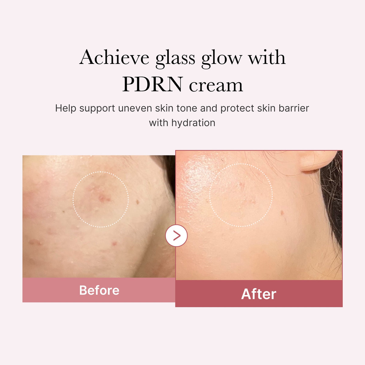 PDRN Pink Peptide Cream P8