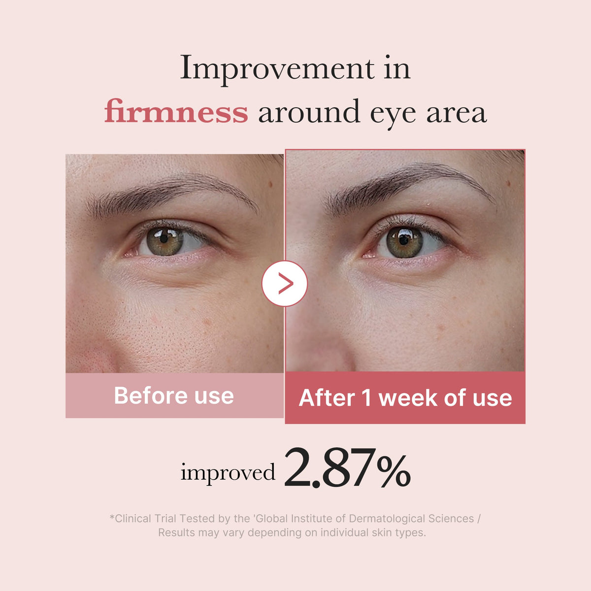 PDRN Pink Peptide Eye Cream B8