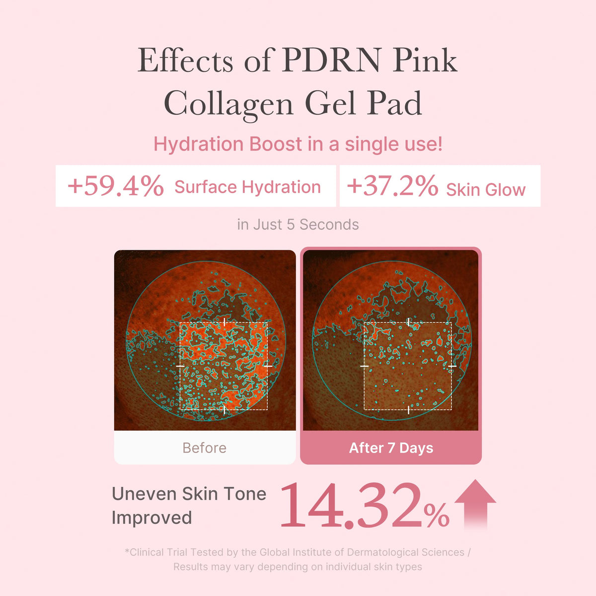 PDRN Pink Collagen Gel Toner Pad S2