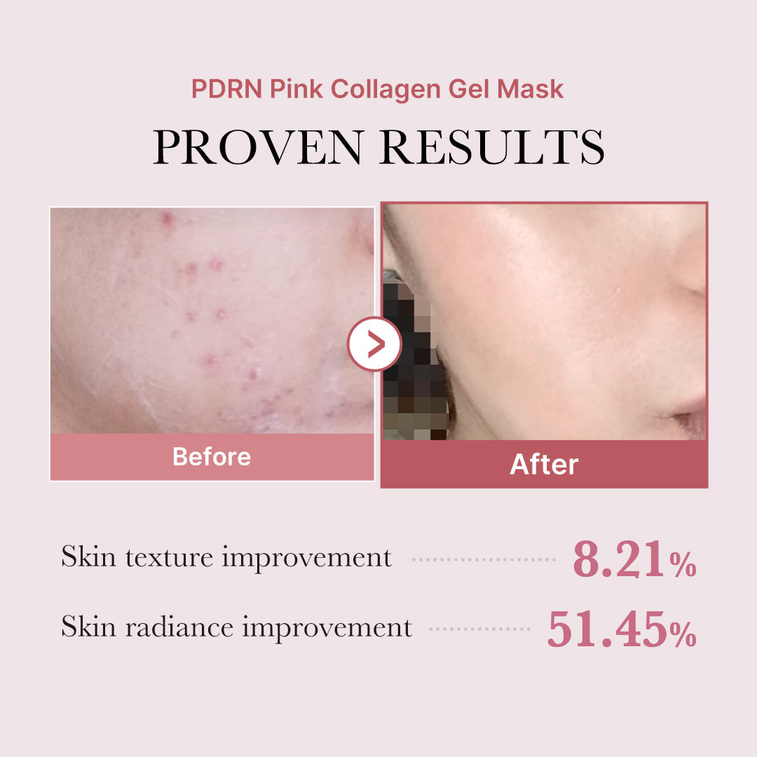 Salmon PDRN Pink Collagen Jelly Gel Mask U8