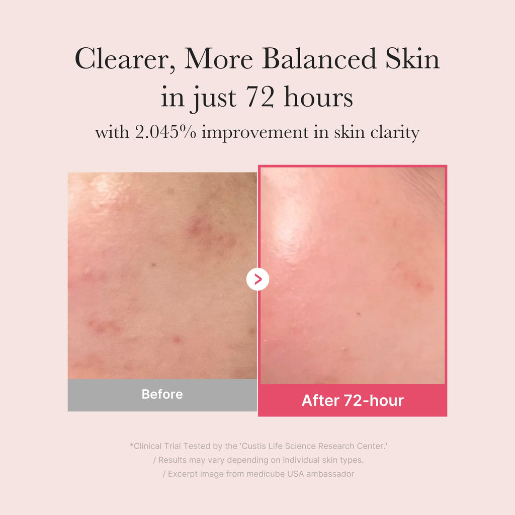 TXA Niacinamide Serum M3