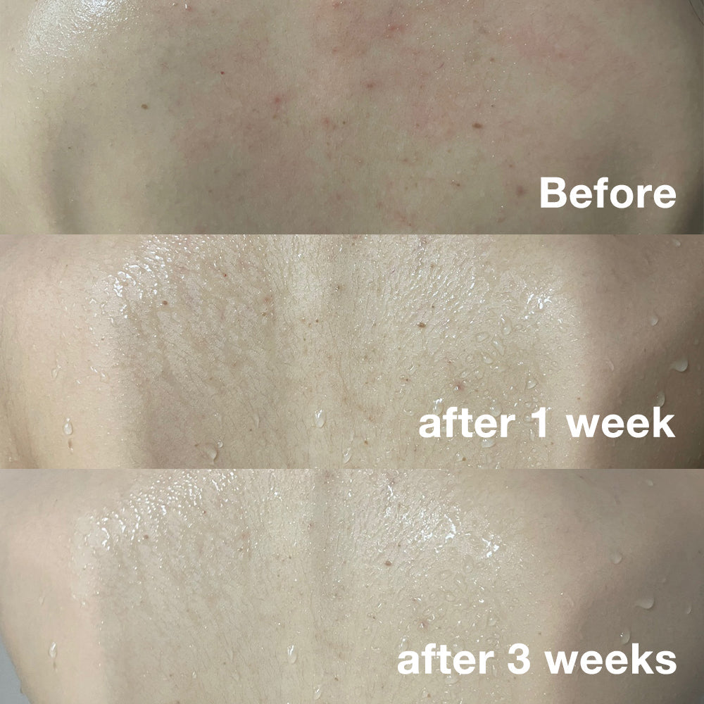 Red Body Wash P4